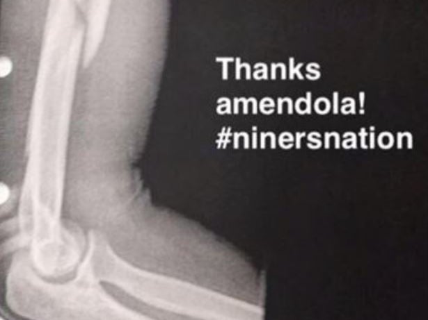 Did Danny Amendola Break A Chick's Arm Arm Wrestling Last Night At Harvard?
