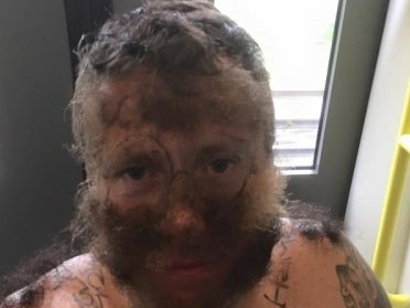 Guy Turned Into A 'Pube Werewolf' By Friends On A Bachelor Party Seriously Needs New Friends Before His Wedding