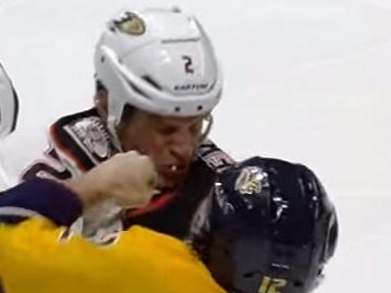 Kevin Bieksa Got A Tooth Punched Out Of His Head Last Night