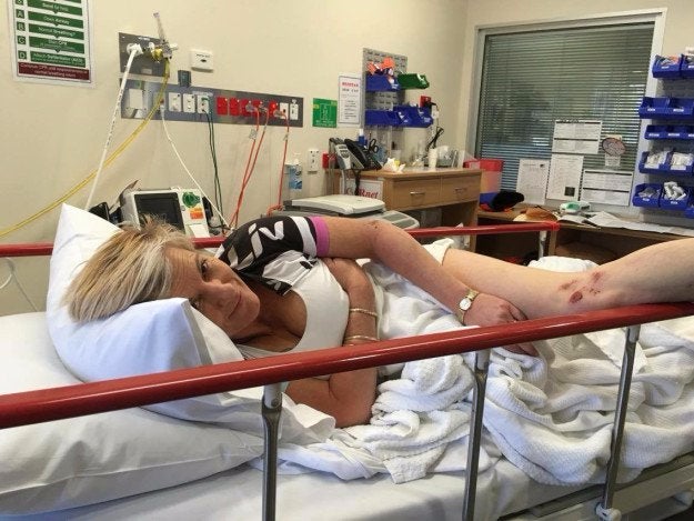 Shoutout To The Kangaroo Who Jumped 2 Cyclists In Australia, Rupturing One's Breast Implants
