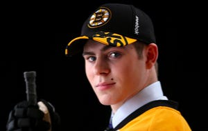 Jake Debrusk loses an already fake tooth, February 26, 2019. It does  nothing to ruin his good looks.
