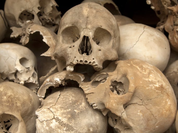 Breaking: eBay Has Officially Banned Human Skulls From Being Sold On Their Site