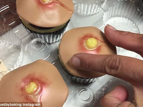 Have Fun Trying To Not Puke At The Sight Of These Pop-a-zit Cupcakes