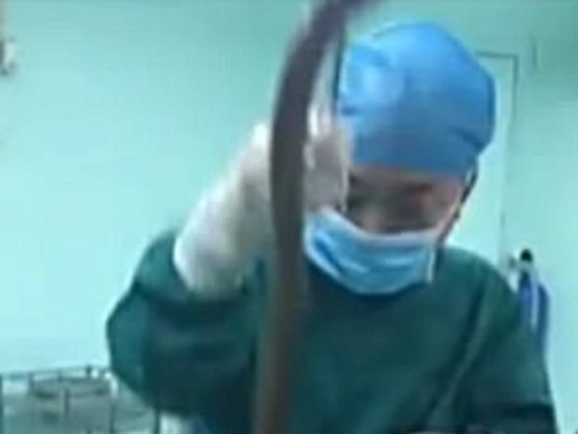 Chinese Man Put Eel Up His Ass To Relieve His Constipation