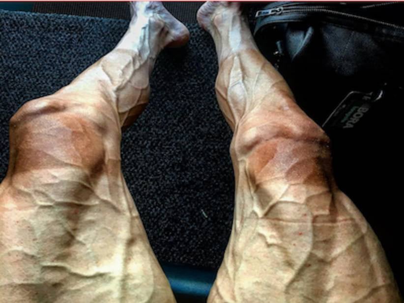 This Cyclist's Legs After 16 Stages Of The Tour De France Are Straight Out Of A Nightmare