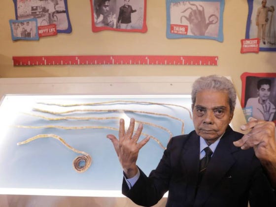 Buddy With World's Longest Fingernails Finally Cuts Them, Leaving His Hand In ROUGH Shape