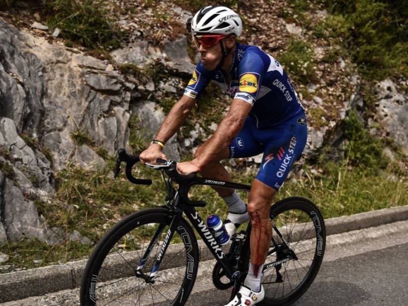 That Tour De France Rider Who Crashed Over A Wall Yesterday? He Shattered His Kneecap But Still Rode For Another 60Km. Must Be A Hockey Player