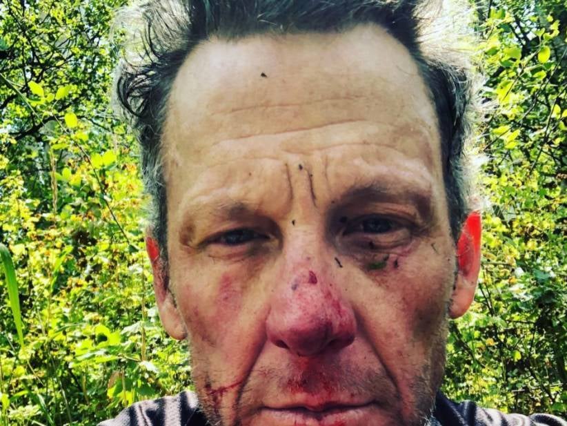 Lance Armstrong Can't Even Ride A Bike Anymore, Falls And Bloodies Up His Face